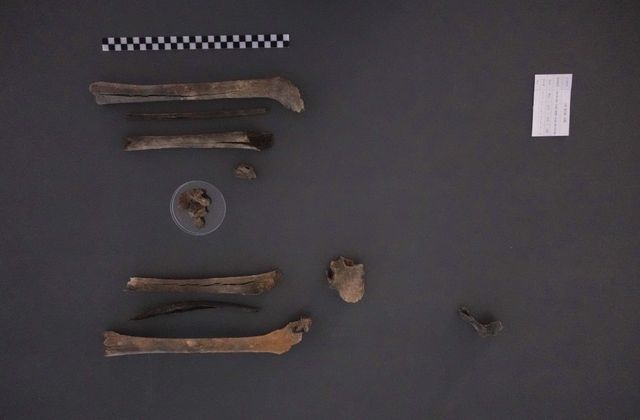 발굴된 고(故) 구자길 일병 유해