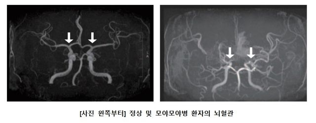 [서울대병원 제공. 재판매 및 DB 금지]