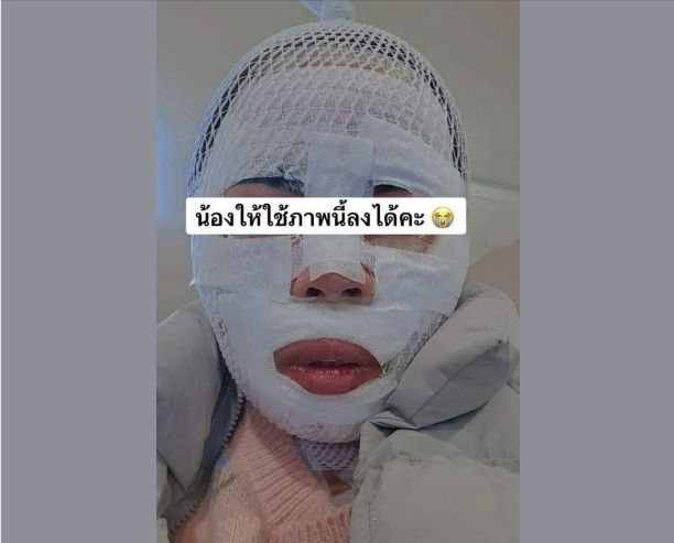 화상 입은 태국인 아내