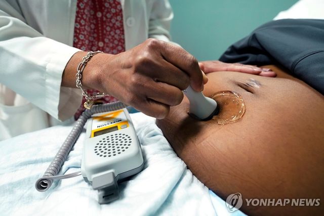 임산부 초음파 검사(사진은 기사내용과 상관없음)