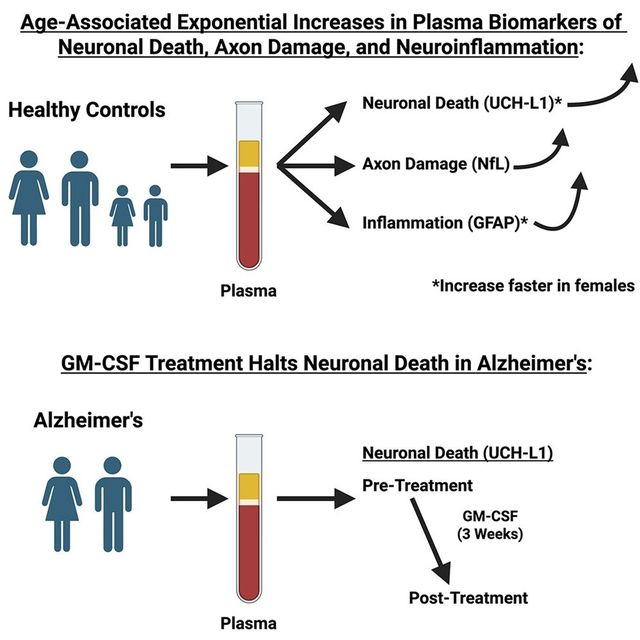 "수십년 된 약물, 알츠하이머병 뇌세포 사멸·인지 저하 완화"