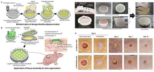 3D 바이오프린팅 기반 지방 조직 모듈 조립체 활용 피부 재생