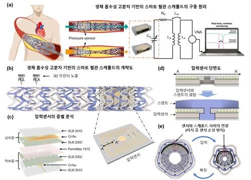 스마트 하이브리드 혈관 스캐폴드 기술 개략도