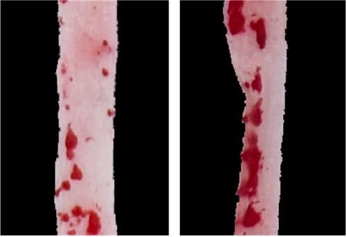 아스파탐 먹은 쥐(오른쪽)와 먹지 않은 생쥐의 동맥 플라크(빨간색) 비교