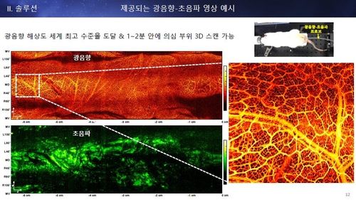 광음향·초음파 내시경으로 찍은 혈관 조직