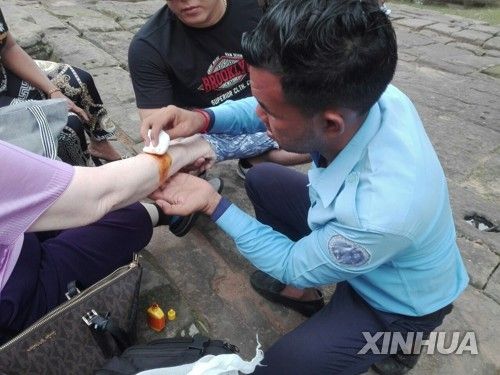 원숭이 때문에 부상한 앙코르와트 관광객