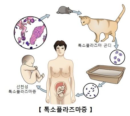 톡소플라즈마증 감염 경로