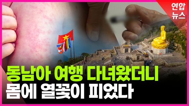 [영상] 전 세계 홍역 유행이라는데…"해외여행 전 백신접종" - 2