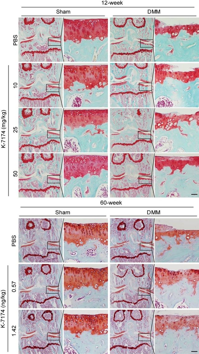 K-7174 투여 결과 연골 손상이 줄어든 모습 