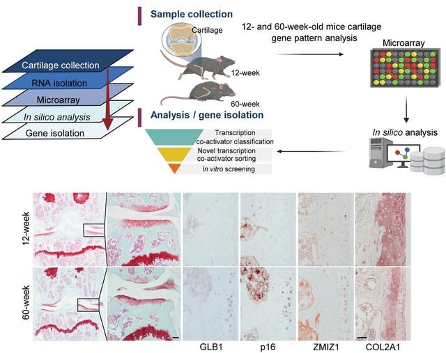 노화 연골세포에서 지미즈1 발현 증가 확인 