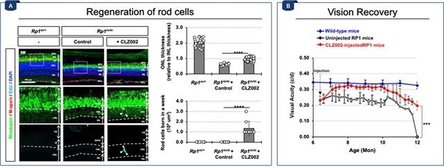 망막 손상 생쥐에 프록스원 차단 치료제를 투여한 결과 