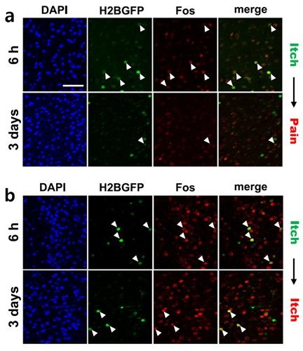 통증과 가려움 자극에 의해 활성화된 뉴런의 시각화
