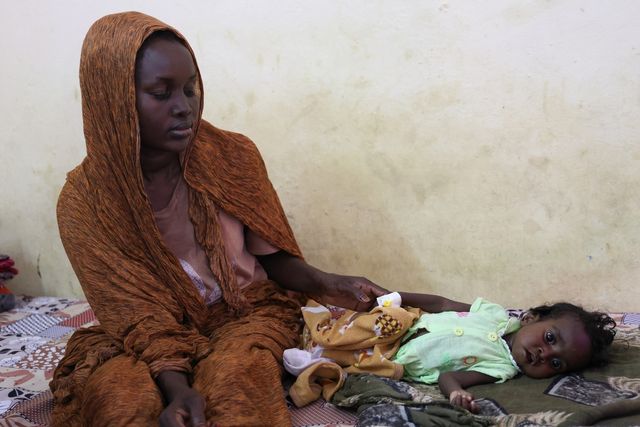 '중증 급성영양실조'로 병원 입원한 수단 난민 아동