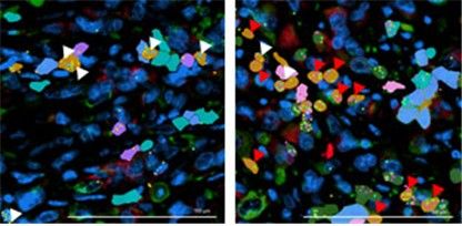 펩타이드 신약 'TB511' 투여 전(왼쪽)과 후(오른쪽)의 종양미세환경 변화