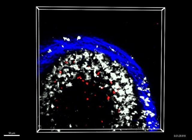 림프절(파란색) 내 대식세포(흰색)와 상호작용하는 기억 B 세포(빨간색)