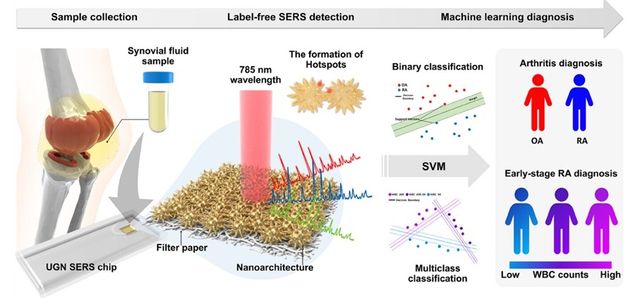 재료연, 체액으로 관절염 신속 진단·구분 기술 개발