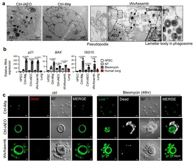 폐포 어셈블로이드의 대식작용 분석 