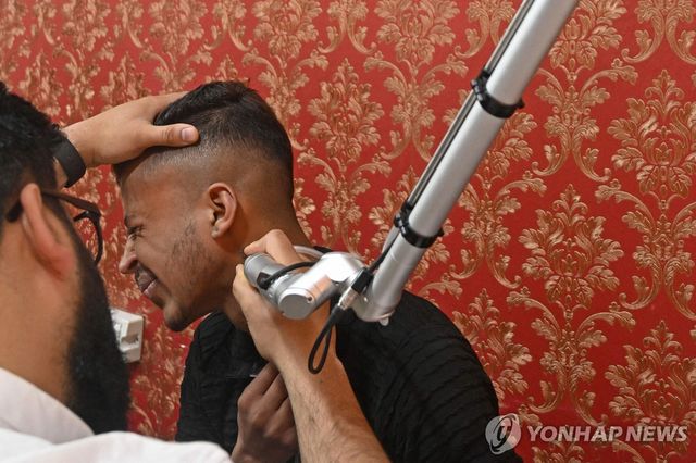 문신 지우는 카슈미르 주민들