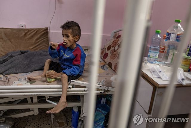 이스라엘의 봉쇄에 따른 굶주림에 심각한 영양실조를 겪고 있는 가자지구의 5세 소년 오스마 알라카브 [EPA 연합뉴스. 재판매 및 DB 금지]