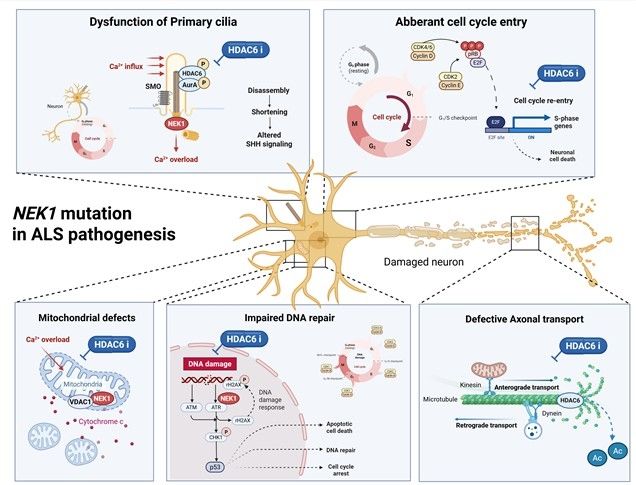 루게릭병 발병에 NEK1 변이가 미치는 영향