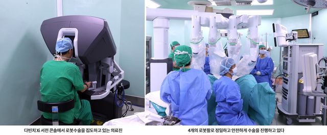로봇수술 모습