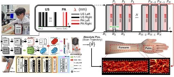 부산대, AI 기반 초음파 3차원 영상 기술 개발