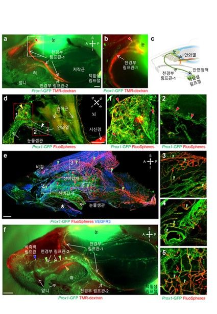 형광물질 이용한 뇌척수액 배출 경로 시각화