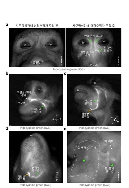 영장류에서의 뇌 척수액 배출 경로