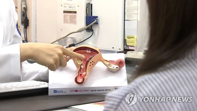 체외수정
