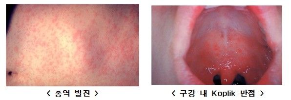 [질병관리청 제공]