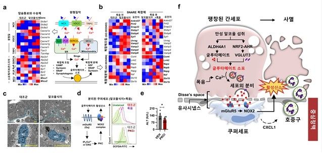 음주 시 간세포 팽창으로 쿠퍼세포와 가까워진 모습 