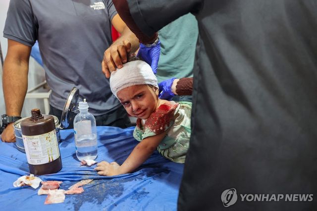 19일(현지시간) 가자지구에서 공습으로 다쳐 치료받고 있는 어린이