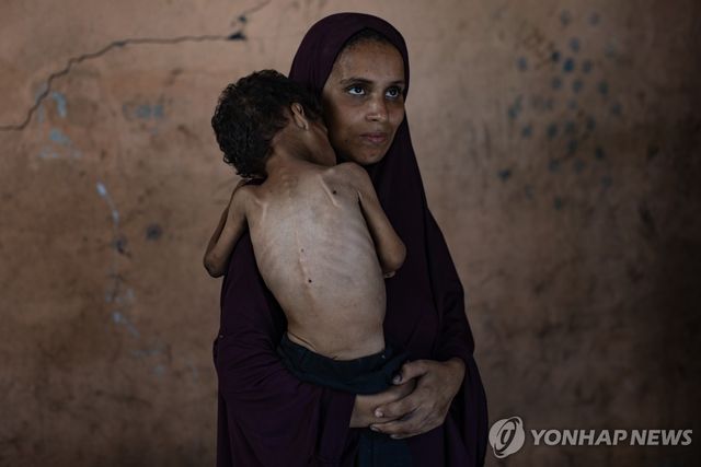 영양 실조에 시달리는 가자지구 어린이. 지난 19일(현지시간) 가자시티 서쪽 난민캠프에서 생활하는 모자의 모습.