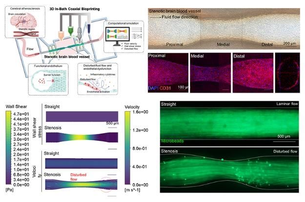 3D 바이오프린팅 기반 협착 뇌혈관 생체 모델 개발 성공 