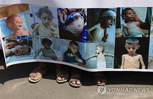 예멘 시위대가 들고 나온 기아 상태 가자 어린이들 사진 