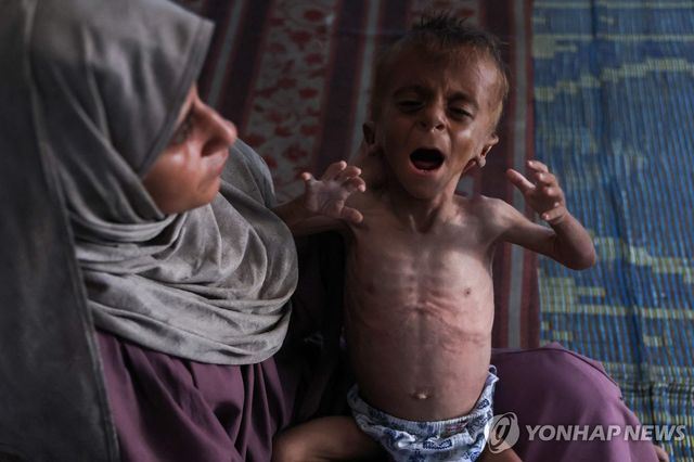 가자지구 난민촌에서 영양실조 상태의 아기를 안고 있는 팔레스타인 여성