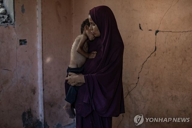 기아에 시달리는 가자지구 아동