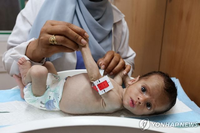 25일(현지시간) 가자지구 남부 칸유니스 나세르 병원에서 간호사가 아동을 진찰하고 있다. [로이터=연합뉴스. 재판매 및 DB 금지]