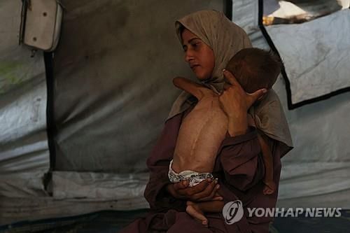 가자지구에 닥친 굶주림 