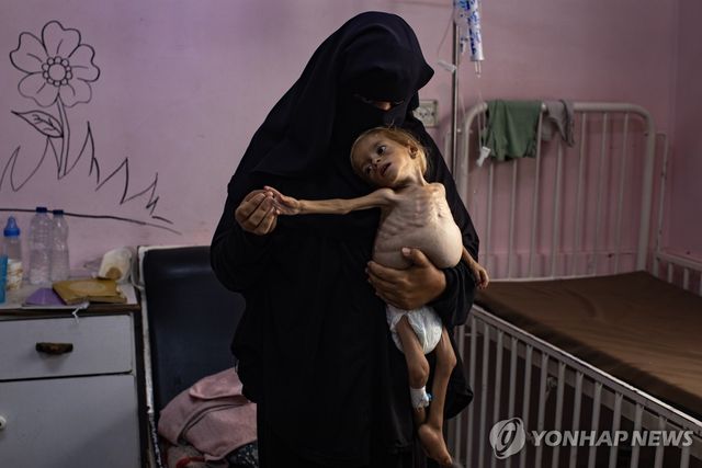 가자지구 칸유니스의 병원에서 치료받는 어린이