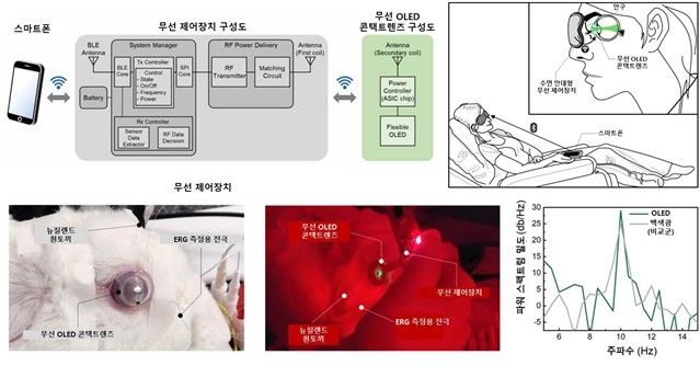 무선 OLED 콘택트렌즈를 활용한 망막전위도 검사