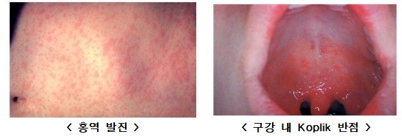 [질병관리청 제공]