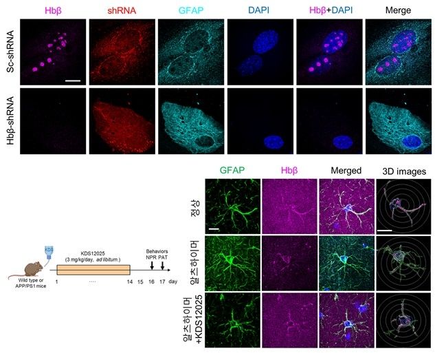 뇌 속 별세포 내 헤모글로빈이 회복된 모습 