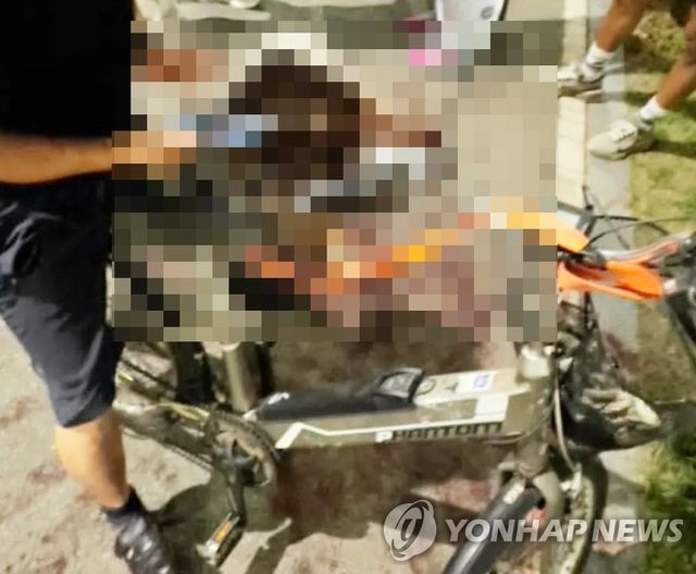 대형견 전기자전거에 매달고 죽을 때까지 달려