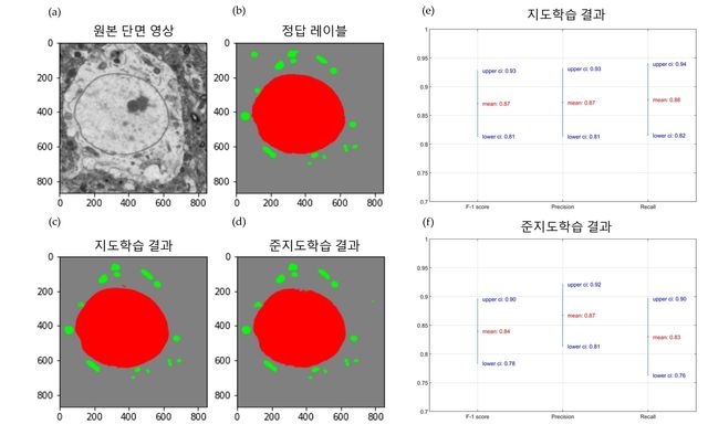 연구팀이 개발한 AI 기반 알고리즘 성능 평가 결과 