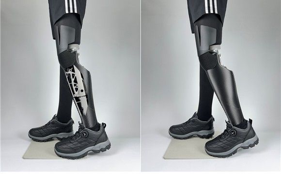 생체모사형 제너레이티브 의족 [근로복지공단 제공. 재판매 및 DB 금지]