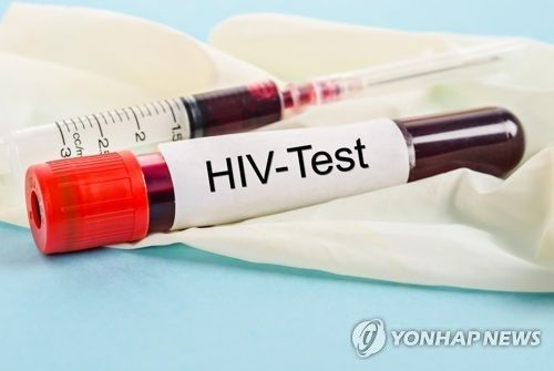 HIV 테스트