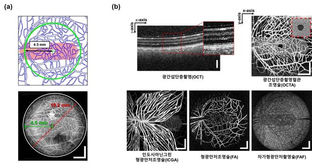 안구 팬텀을 이용한 영상진단장비 성능 평가 결과 