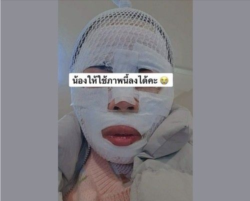 화상 입은 태국인 아내