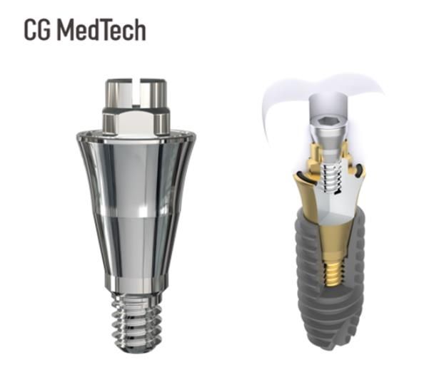 시지메드텍, 신제품 '우루덴트 SA' 출시
